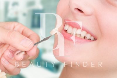 Dr. Jack’s Dental Clinic, top Dentist from Dubai, Beauty Finder - 0