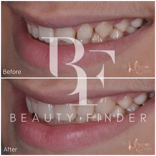 Dr. Maysoon Cosmetic Dentist, top Dentist from Dubai, Beauty Finder - 1