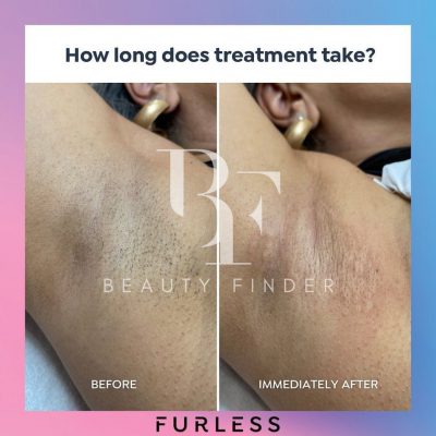 Furless Permanent SZR, top Laser Treatments Salon from Dubai, Beauty Finder - 0