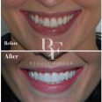 Invisalign Provider McBody, top Dentist from Dubai, Beauty Finder - 1