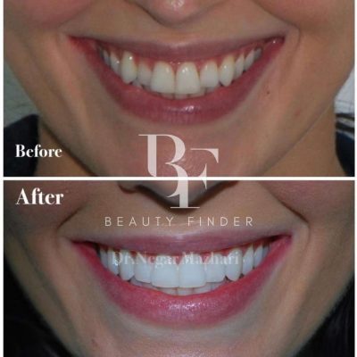 Invisalign Provider McBody, top Dentist from Dubai, Beauty Finder - 1