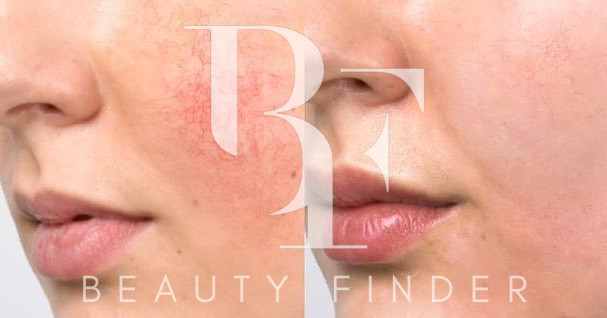 Lelara Aesthetic Clinic, top Aesthetic Salon from Dubai, Beauty Finder - 0