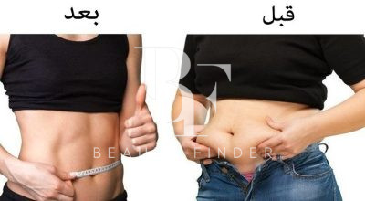 Dr. Khaldoun Dweikat AlAbbadi Clinic, top Plastic Surgery from Jordan, Beauty Finder - 6