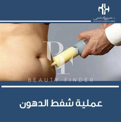 Dr. Khaldoun Dweikat AlAbbadi Clinic, top Plastic Surgery from Jordan, Beauty Finder - 1