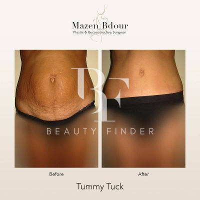 Mazen Bdour Clinic, top Plastic Surgery from Jordan, Beauty Finder - 8