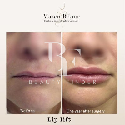 Mazen Bdour Clinic, top Plastic Surgery from Jordan, Beauty Finder - 6