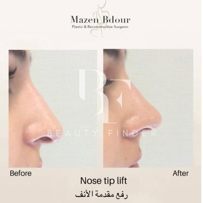 Mazen Bdour Clinic, top Plastic Surgery from Jordan, Beauty Finder - 9