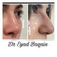 Dr. Eyad Baqain, top Plastic Surgery from Jordan, Beauty Finder - 3