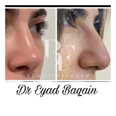 Dr. Eyad Baqain, top Plastic Surgery from Jordan, Beauty Finder - 3