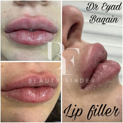 Dr. Eyad Baqain, top Plastic Surgery from Jordan, Beauty Finder - 2