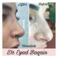 Dr. Eyad Baqain, top Plastic Surgery from Jordan, Beauty Finder - 5