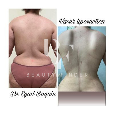 Dr. Eyad Baqain, top Plastic Surgery from Jordan, Beauty Finder - 6