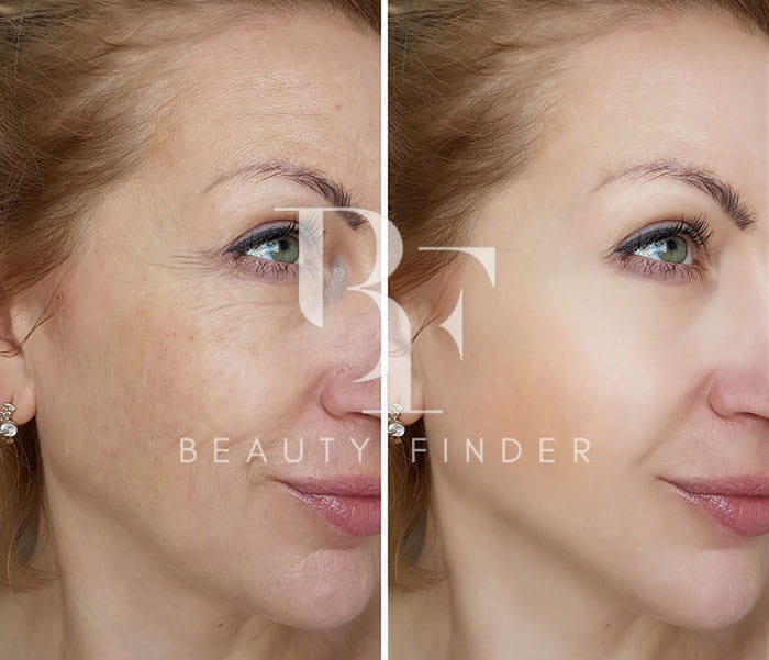 Dermacare Clinic, top Aesthetic Salon from Jordan, Beauty Finder - 3