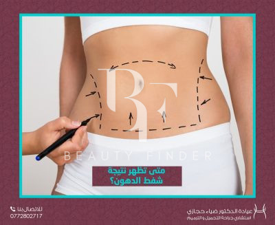 Hijazi Plastic Surgery Clinic, top Plastic Surgery from Jordan, Beauty Finder - 4