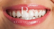 Bissan Dental Center, top Dentist from Dubai, Beauty Finder - 2