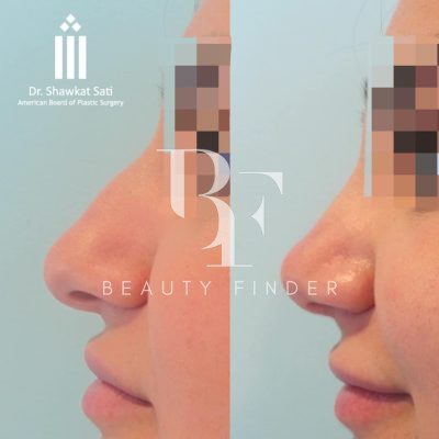 Dr.Shawkat Sati, top Plastic Surgery from Jordan, Beauty Finder - 3