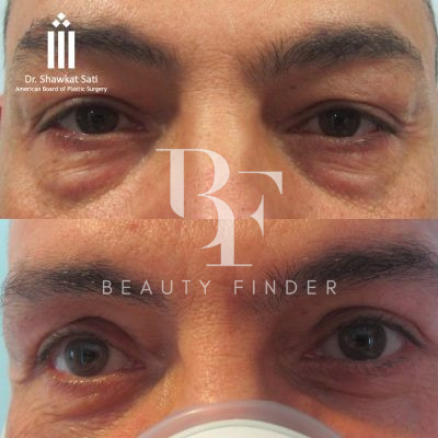 Dr.Shawkat Sati, top Plastic Surgery from Jordan, Beauty Finder - 4