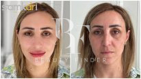 Dr Samkari Clinic, top Plastic Surgery from Jordan, Beauty Finder - 5