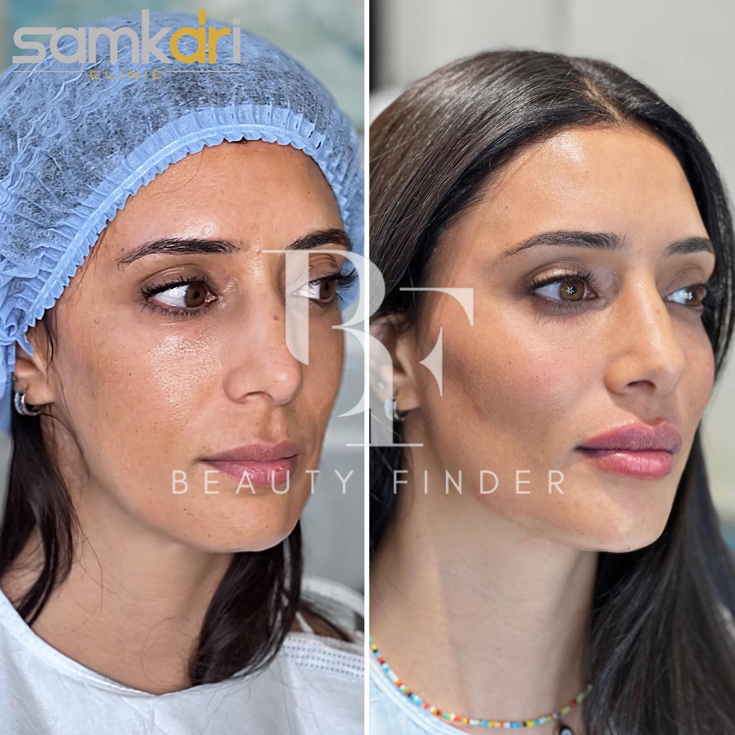 Dr Samkari Clinic, top Plastic Surgery from Jordan, Beauty Finder - 2