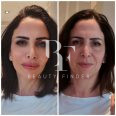 Dr Samkari Clinic, top Plastic Surgery from Jordan, Beauty Finder - 4