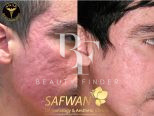 Dr. Safwan Clinics, top Aesthetic Salon from Jordan, Beauty Finder - 3