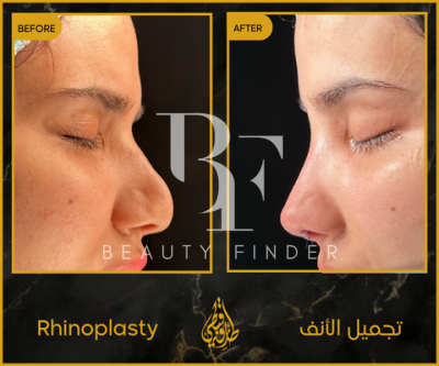 Dr. Tarek Copty Plastic Surgery Clinic, top Plastic Surgery from Jordan, Beauty Finder - 3