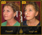 Dr. Tarek Copty Plastic Surgery Clinic, top Plastic Surgery from Jordan, Beauty Finder - 5