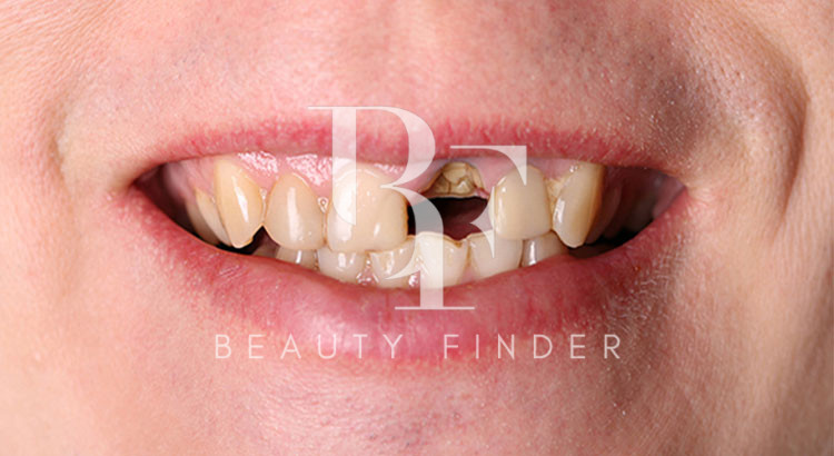 Bissan Dental Center, top Dentist from Dubai, Beauty Finder - 1