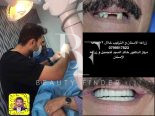 Dr. Khaled AlSayed-Dentist, top Dentist from Jordan, Beauty Finder - 2