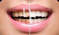 Dental Department at Abeer Medical Center – Batha, top Dentist from Saudi Arabia, Beauty Finder - 2