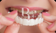 Dental Department at Abeer Medical Center – Batha, top Dentist from Saudi Arabia, Beauty Finder - 9