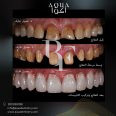 Aquadent Clinics, top Dentist from Saudi Arabia, Beauty Finder - 4