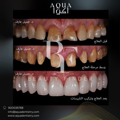 Aquadent Clinics, top Dentist from Saudi Arabia, Beauty Finder - 4