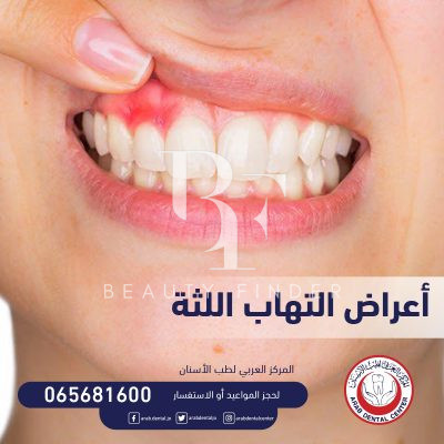 Arab Dental Center, top Dentist from Jordan, Beauty Finder - 6