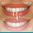 Al Sundos Dental Care, top Dentist from Saudi Arabia, Beauty Finder - 3