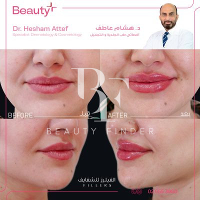 Beauty Plus Medical Center, top Aesthetic Salon from Abu Dhabi, Beauty Finder - 9