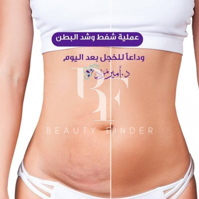 Dr. Amir Murad Plastic Surgery, top Plastic Surgery from Saudi Arabia, Beauty Finder - 9