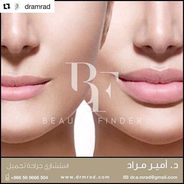 Dr. Amir Murad Plastic Surgery, top Plastic Surgery from Saudi Arabia, Beauty Finder - 10
