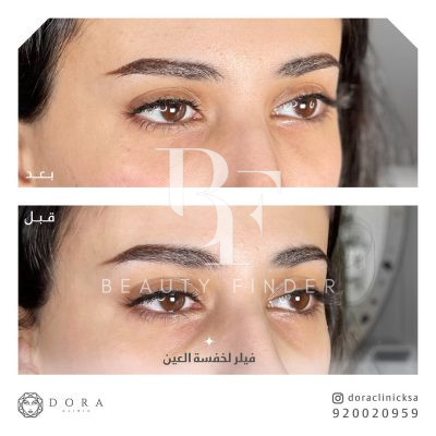 Dora Clinic, top Cosmetology Salon from Saudi Arabia, Beauty Finder - 7