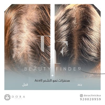 Dora Clinic, top Cosmetology Salon from Saudi Arabia, Beauty Finder - 8