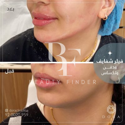 Dora Clinic, top Cosmetology Salon from Saudi Arabia, Beauty Finder - 9