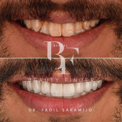 Designers Clinic, top Dentist from Saudi Arabia, Beauty Finder - 6