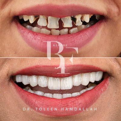 Designers Clinic, top Dentist from Saudi Arabia, Beauty Finder - 8