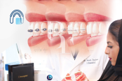 Dentalia Clinics, top Dentist from Saudi Arabia, Beauty Finder - 5