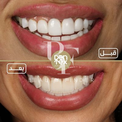 Dentex Dental Clinic, top Dentist from Saudi Arabia, Beauty Finder - 2