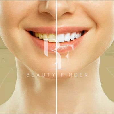 Dentex Dental Clinic, top Dentist from Saudi Arabia, Beauty Finder - 6