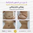 Elyzee Hospital – Abu Dhabi, top Body Treatments Salon from Abu Dhabi, Beauty Finder - 3