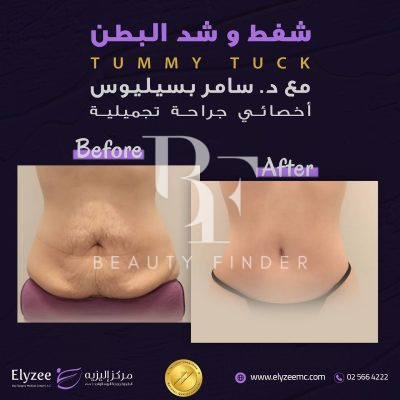 Elyzee Hospital – Abu Dhabi, top Body Treatments Salon from Abu Dhabi, Beauty Finder - 4