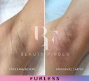 Furless Permanent, top Laser Treatments Salon from Abu Dhabi, Beauty Finder - 14