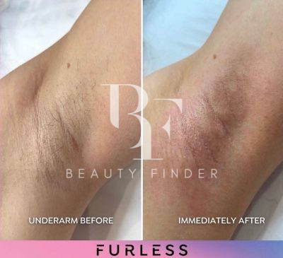 Furless Permanent, top Laser Treatments Salon from Abu Dhabi, Beauty Finder - 14